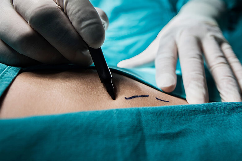 Plastic surgeon preparing for surgery